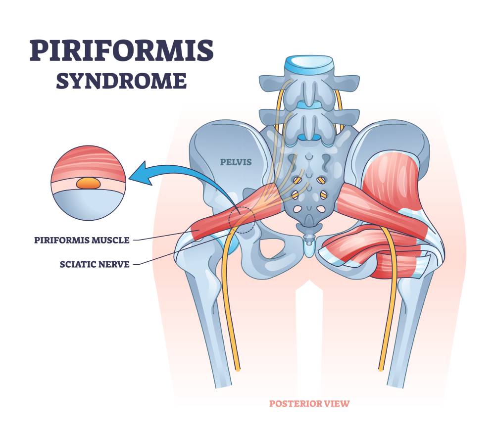 piriformis 1