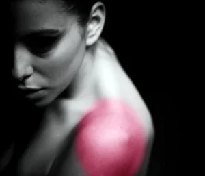 Frozen Shoulder - The Causes 2 physiotherapy