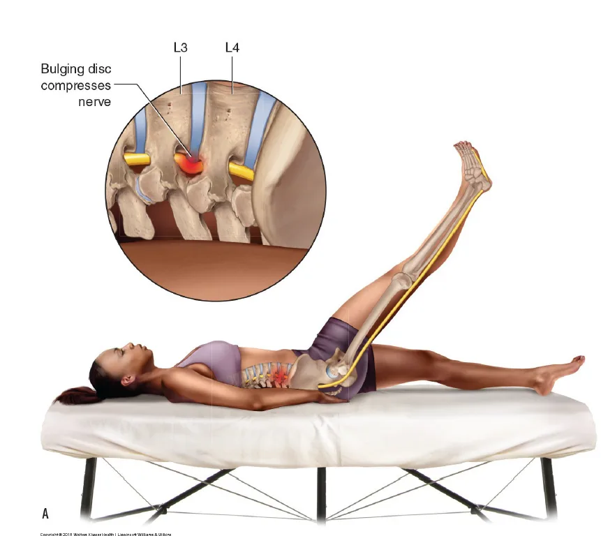STRAIGHT LEG RAISE ORTHOPEDIC ASSESSMENT TEST. PERMISSION: JOSEPH E. MUSCOLINO. PERMISSION: JOSEPH E. MUSCOLINO. MANUAL THERAPY FOR THE LOW BACK AND PELVIS (2015).